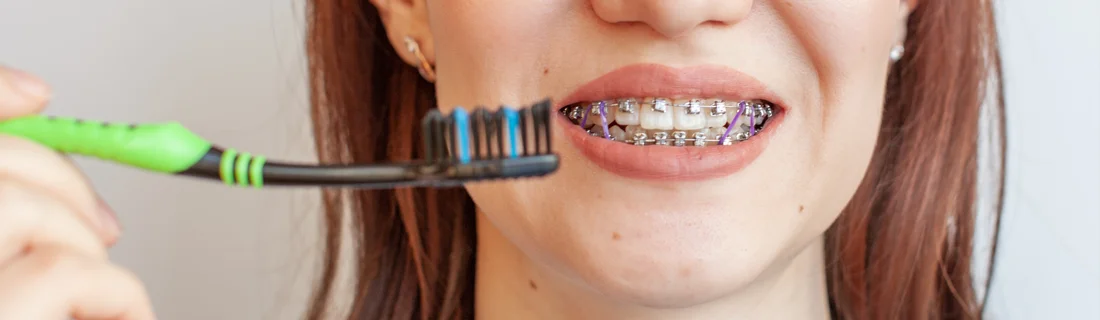 Dentist Aurora IL Brushing Teeth with Brace