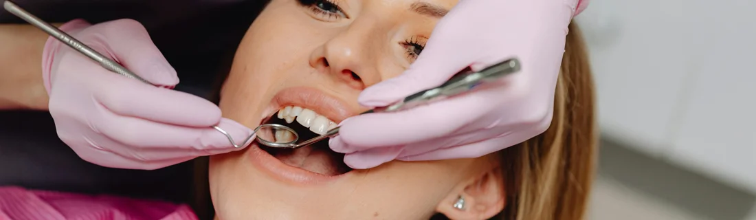 Dentist Aurora IL Cleanings and Exams