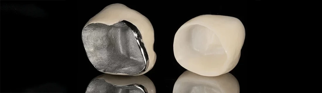 The inside of two different types of crowns